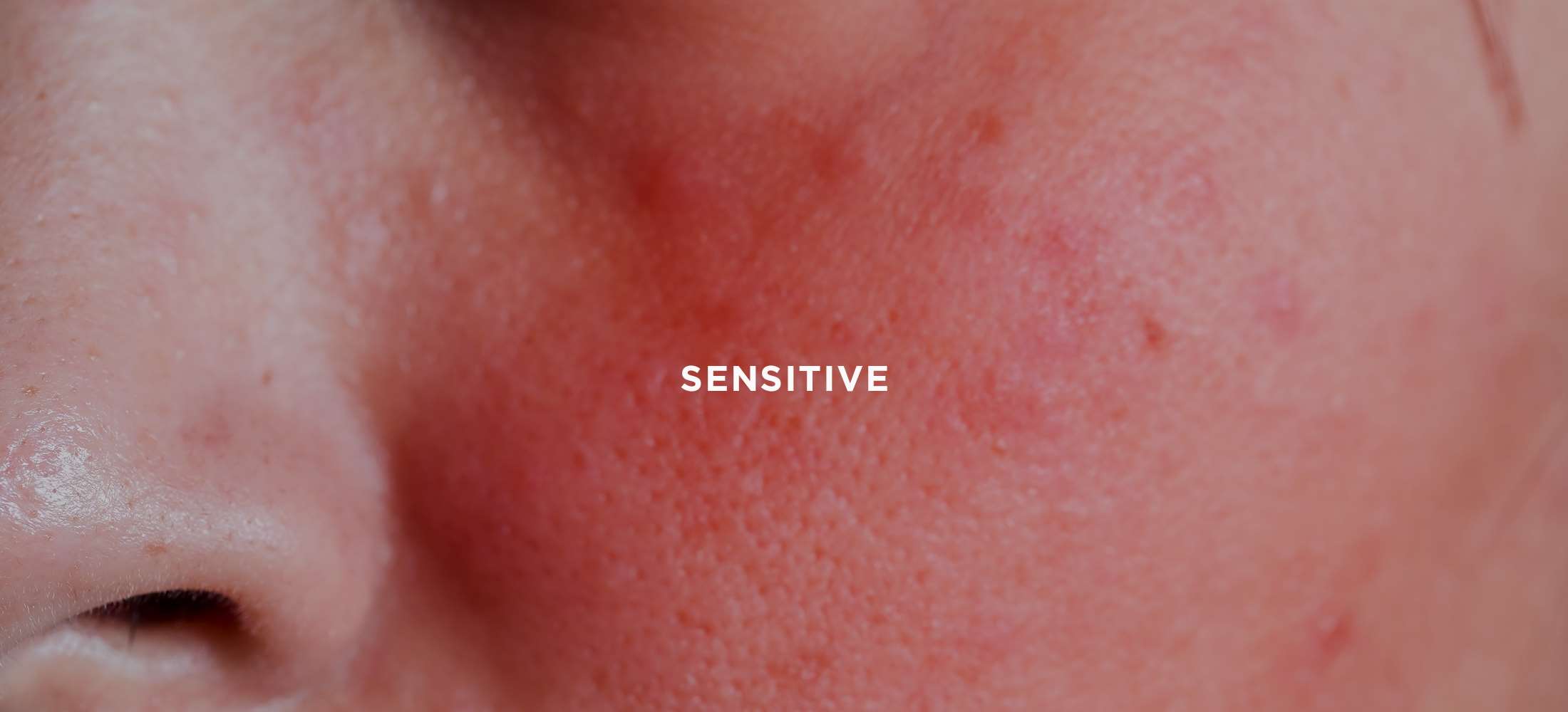 eng_treatment_concerns_sensitive