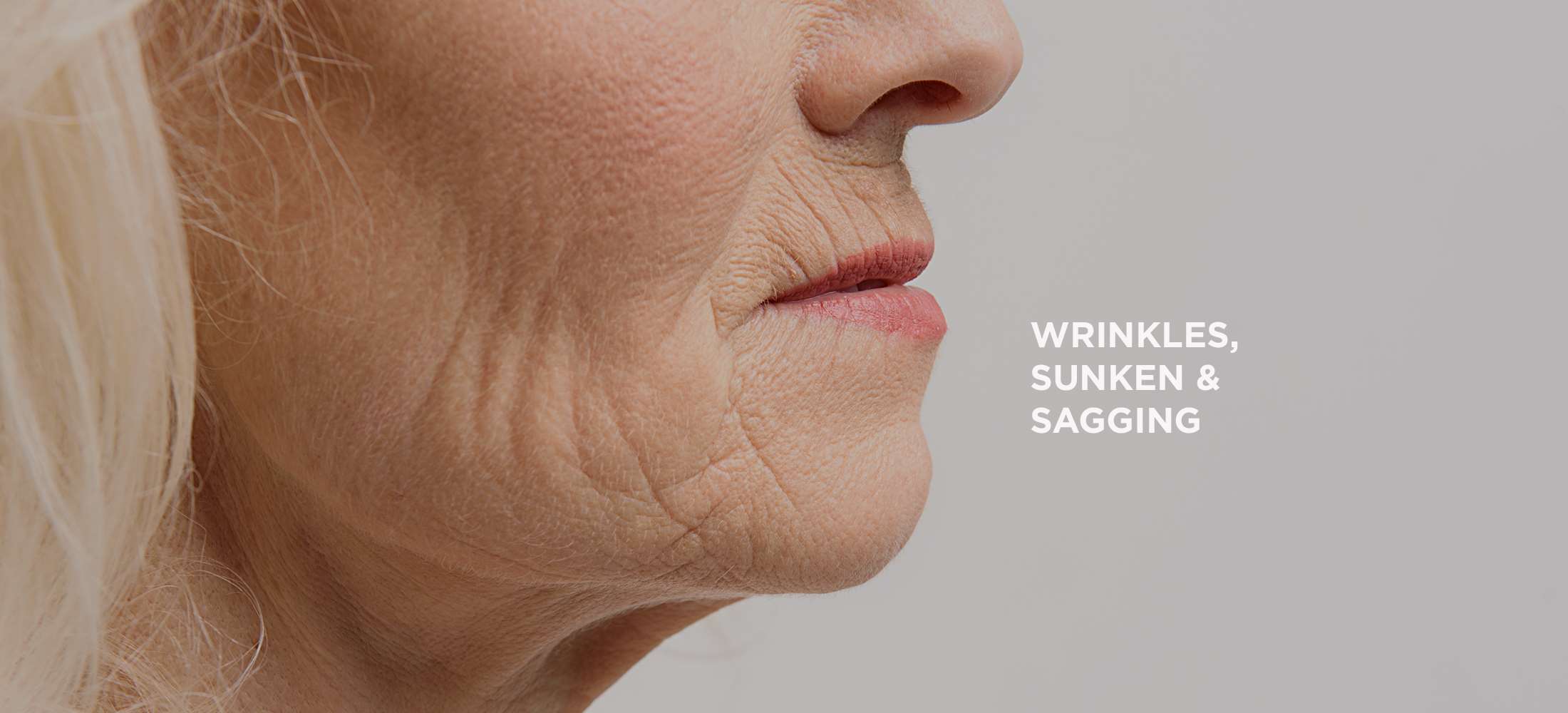 eng_treatment_concerns_wrinkles